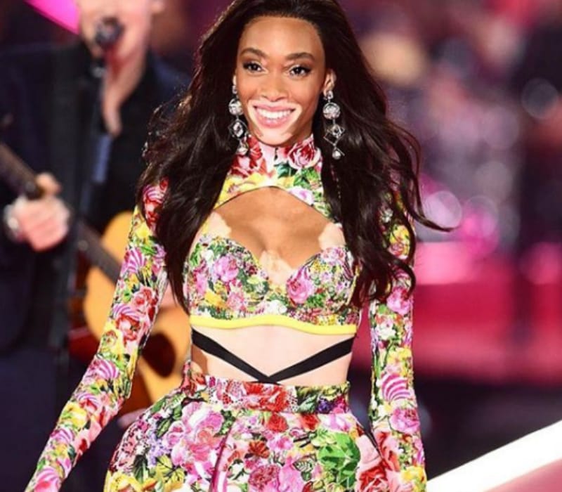 Winnie Harlow Height Age Boyfriend Wiki Net Worth Affair